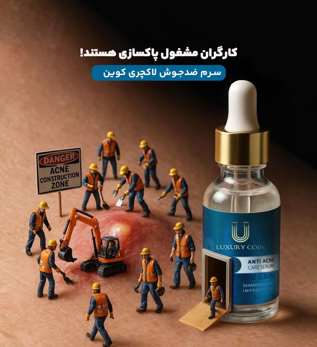 سرم ضدجوش لاکچری کوین